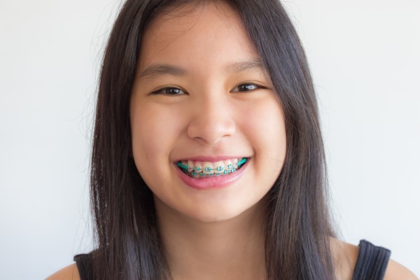 Braces For Teens: Finding The Right Option For Your Child