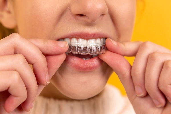 Teeth Straightening With Clear Aligners