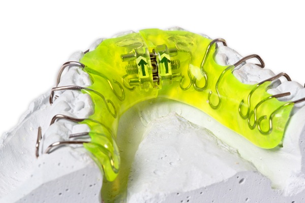 How Retainers Keep Your Smile Aligned